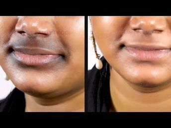 Dark Skin Around Mouth, Black Patch, Dark Corners, Dark Circles, Dark Spots, Dark Black, Circles, Skin, Black