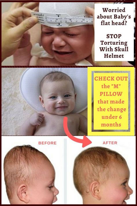 Do You Really need baby flat head helmet ? Flat spots in baby head is a common problem. How do you handle baby flat head without clunky flat head helmet that irritates baby?   This baby pillow has made the change easily without even trying. #flatheadpillow #babyflathead #Plagiocephaly Flat Head Pillow, Flat Head Baby, Flat Head Syndrome, Baby Helmet, Skull Helmet, Baby Spa, All About Mom, Infant Adoption, Baby Planning