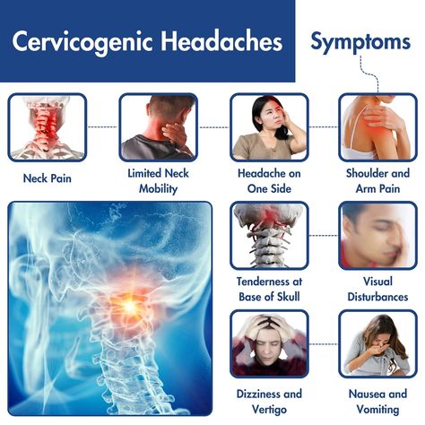 Can Neck pain cause headaches?
Neck pain can cause headaches: 
Cervicogenic headache
A chronic headache that originates in the neck and can radiate from an injury or condition in the cervical spine, such as arthritis or a slipped disk.
Tension headache
A headache that occurs when the neck and scalp muscles contract or become tense. 
Pinched nerve
A pinched nerve in the neck can cause a throbbing headache
Poor posture
Poor posture can strain muscles and tendons, Cervicogenic Headache, Neck Headache, Throbbing Headache, Cervical Spondylosis, Pinched Nerve, Cervical Spine, Alpha Omega, Muscle Strain, Tension Headache