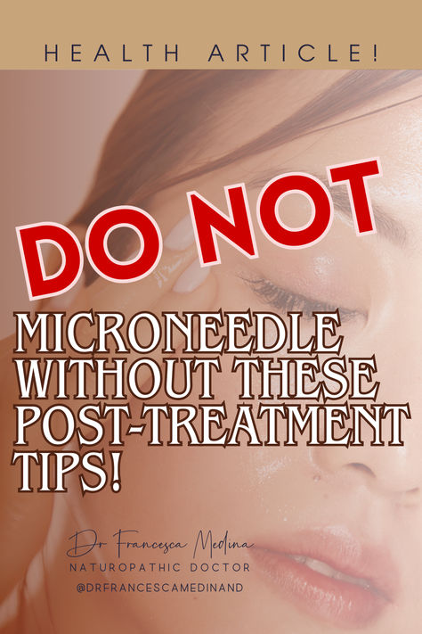 Ready to transform your skin? Discover the magic of microneedling with SkinPen, enhanced by PRP and BioJuve! Learn about the process, benefits, and aftercare in my latest blog post. Click to read and book your appointment with Dr. Francesca Medina today! #SkinCareRoutine #Microneedling #BeautyTips #RadiantSkin #SkinPen #BioJuve #AntiAging How To Microneedle At Home, Before And After Microneedling, Skin Pen Microneedling, Microneedling After Care, Microneedling Before And After, At Home Microneedling, Microneedling Benefits, Benefits Of Microneedling, Microneedling At Home