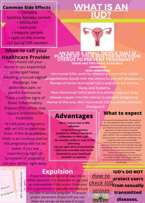 Iud Side Effects, Iud Removal, Spotting Between Periods, Period Headaches, Irregular Periods, Birth Control, Side Effects, Headache, Back Pain