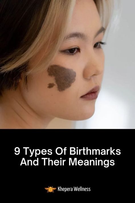 9 Types Of Birthmarks And Their Meanings - Khepera Wellness Meaning Of Birthmarks, Birth Marks Meaning, Beauty Marks On Face Meaning, Cool Birthmarks, Cute Birthmarks, Types Of Dimples, Birthmark On Face, Birthmarks Aesthetic, Birthmark Meaning