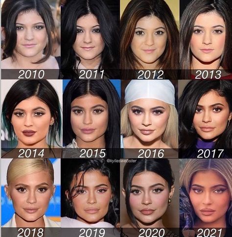 Kylie Jenner on Instagram: “The glow up #kuwtk #kuwtkclips #kardashiankollection #halloween #halloweenmakeup #halloweencostume #kyliejenner #kylijennerstyle…” Kylie Jenner Plastic Surgery, Cheek Implants, Tag Your Best Friend, Kylie Kardashian, Hair Growth Kit, Chin Augmentation, Botox Lips, Wardrobe Fashion, Celebrity Plastic Surgery