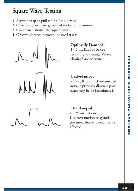 Arterial line square wave testing Arterial Line Nursing, Cvicu Nursing, Cardiac Output Nursing, Arterial Line, Cardiovascular Assessment Nursing, Cardiac Tamponade Nursing, V Fib Cardiac Rhythms, Cardiac Arrhythmias Nursing, Wound Care Nursing