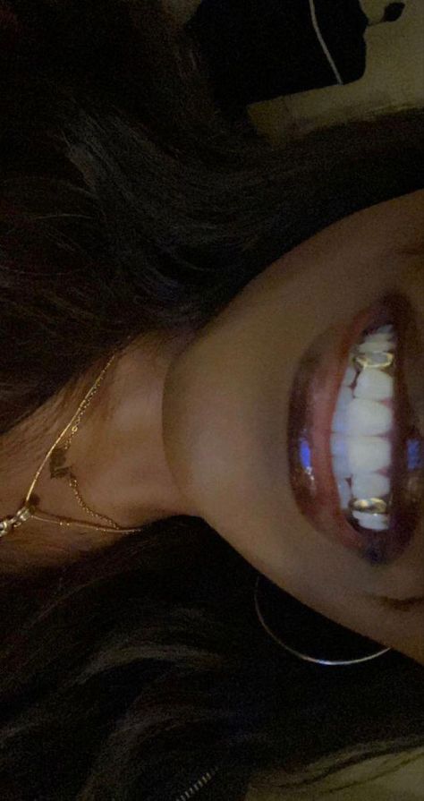 #WhatIsOralCareProcedure Gold Teeth Grills, Smile Tips, Pretty Teeth, Grillz Teeth, Teeth Caps, Strong Teeth, Dope Jewelry Accessories, Grills Teeth, Teeth Jewelry