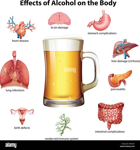 Download this stock vector: Effects of alcohol on the body illustration - PAK2CE from Alamy's library of millions of high resolution stock photos, illustrations and vectors. Alcohol Effects On Body, Alcohol Awareness, Healthy Heart Tips, Background Heart, Lung Infection, Effects Of Alcohol, Digestive Juice, Natural Antibiotics, Mango Recipes