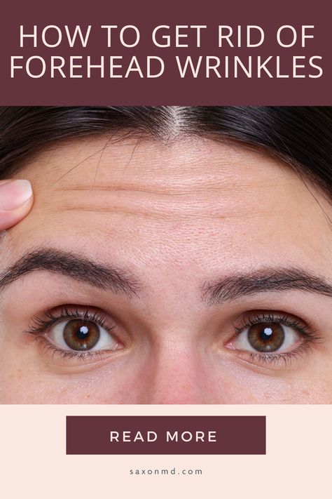 Considering a brow lift or just want smoother, youthful skin? Discover the top ways to reduce forehead wrinkles—from skincare tips to surgical options! 💆‍♀️ #BrowLift #YouthfulSkin #ForeheadWrinkles #AntiAging #Glow Get Rid Of Forehead Wrinkles, Reduce Forehead Wrinkles, Forehead Wrinkles, Brow Lift, Skin Remedies, Anti Aging Tips, Age Defying, Skincare Tips, Youthful Skin