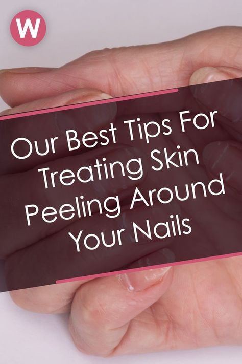 Few sensations are as uncomfortable as peeling skin around your nails. At best, it's a nuisance, but at worst, it's painful — especially when the skin starts to crack and become raw, or when it gets caught on your clothes. #nails #healthynails #peelingnails #manicure #cuticles Peeling Fingertips, Peeling Nails, Peeling Skin, Healthy Nails, Beauty Trends, You Nailed It, Manicure, Skin, Nails