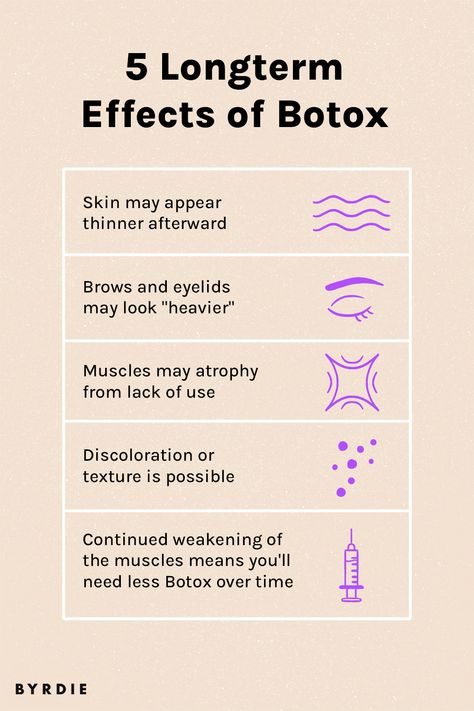 Botox Injection Sites Diagram, Feed Photos, Botox Injection Sites, Facial Injections, Embracing Diversity, Facial Fillers, Burn Stomach Fat, Facial Aesthetics, Aesthetic Feed