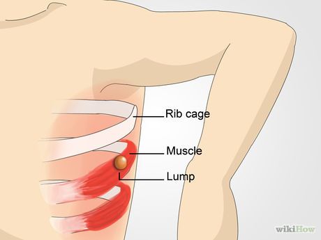 Lymph Nodes Armpit, Lymph Node Pain, Drainage Massage, Lymph System, Elbow Pain, Lymph Drainage, Trigger Point, Lymph Nodes, Healthy Ideas