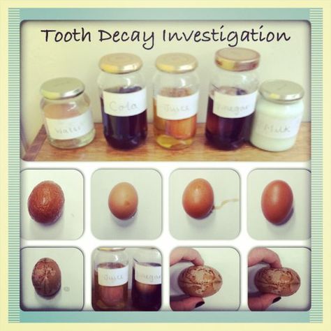 Egg experiment - tooth decay Y3: Tooth Decay Science Fair Project, Science Fair Projects For Elementary, Kindergarten Science Fair Projects, Middle School Science Fair Projects, Egg Science, Egg Experiment, Science Kindergarten, Science Fair Board, Science Fair Experiments