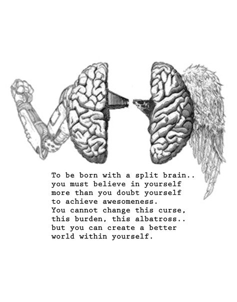 An illustration and quote concerning Agenesis of the Corpus Callosum, or split brain. Corpus Callosum, Human Body Facts, Brain Anatomy, Science Lover, Anatomy Study, Special Kids, School Psychology, Science Biology, Human Brain