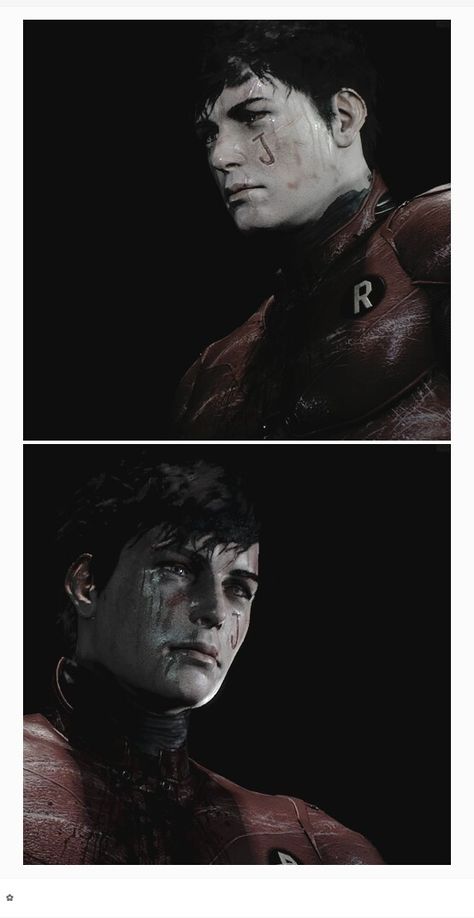 Jason Todd. you can see the tear tracks on his face. Jason Todd Batman Arkham Knight, Arkham Knight Jason Todd Art, Jason Todd Smile, Jason Todd Face Claim, Jason Todd Tattoo Ideas, Jason Todd Fancast, Jason Todd Scars, Jason Todd And Joker, Jason Todd Torture