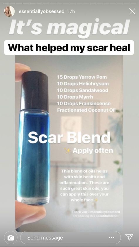 Essential oil blend to heal scars Oils For Scars, Medicine Tips, Doterra Essential Oils Recipes, Skin Tags, Cold Sores Remedies, Eye Exercises, Natural Sleep Remedies, Natural Cold Remedies, Natural Cough Remedies