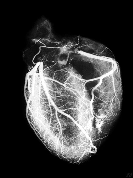 Xray Art, Love Is A Verb, Patterns Of Fashion, Microscopic Images, Heart Pictures, Human Heart, Cardiology, Black Dog, Black Bird