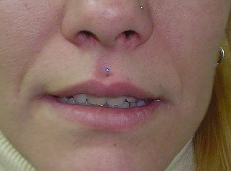 Medusa Piercing Small Lips, Medusa Piercing Scar, Medusa Piercings, Lips Piercing, Piercing Guide, Upper Lip Piercing, Dimple Piercing, Philtrum Piercing, Medusa Piercing