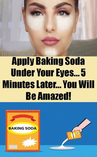 Baking Soda Under Eyes, Baking Soda Face Mask, Baking Soda Face, Baking Soda Benefits, Natural Mask, Baking Soda Shampoo, Acne Free, Homemade Face, Sodium Bicarbonate