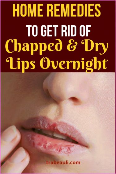 Amazingly Simple Graphic Design Software – Canva Remedies For Chapped Lips, Dry Lips Remedy, Chapped Lips Remedy, Overnight Remedies, Dehydrated Lips, Homemade Facial, Dry Cracked Lips, Winter Lips, Homemade Facial Mask