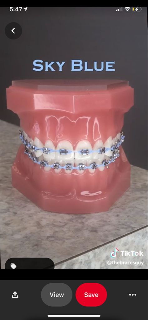 Light Blue Power Chain Braces, Navy Blue Power Chain Braces, Braces Sky Blue, Baby Blue Braces, Braces Colors Ideas Power Chains, Sky Blue Braces, Light Blue Braces, Power Chain Braces, Dental Braces Colors