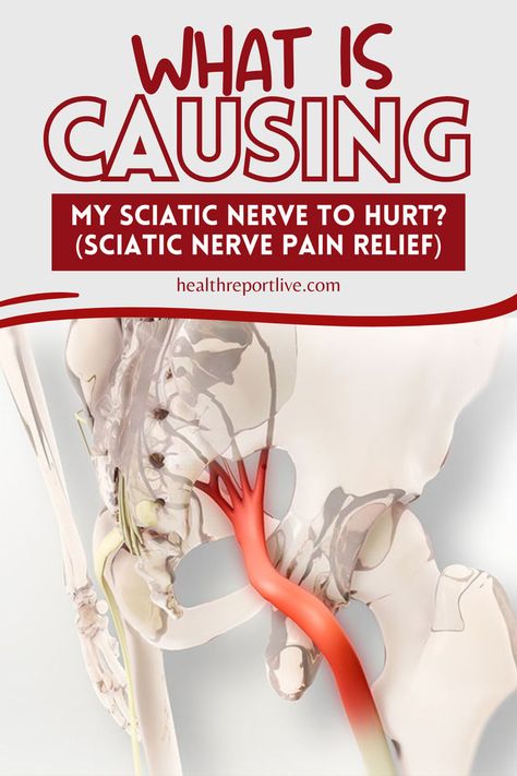 Illustration of a human pelvic and leg skeleton with a red highlighted sciatic nerve, accompanied by text "What is causing my sciatic nerve to hurt? (Sciatic Nerve Pain Relief)" and website URL healthreportlive.com. Pinched Nerve In Hip Relief, Pinched Sciatic Nerve Relief, Sciatic Nerve Relief Remedies Natural Treatments, Ciatica Pain Relief, Pinched Nerve In Lower Back, Pinched Sciatic Nerve, Nerve Pain Remedies, Nerve Relief, Sciatic Nerve Relief