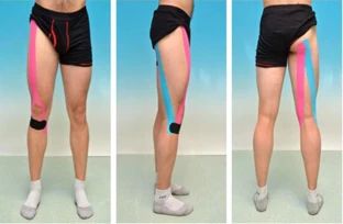 Kinesio Taping Knee, Knee Ligament Injury, K Tape, Knee Ligaments, Anterior Cruciate Ligament, Kinesio Tape, Kt Tape, Kinesio Taping, Strength And Conditioning Coach