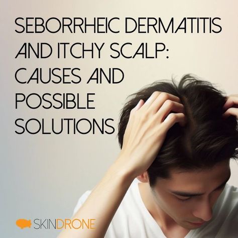 Seborrheic dermatitis is a common skin condition that causes flaky, dry, white to yellowish scales to form on oily areas like the scalp, face, or inside the ear. It can occur with mild dandruff or progress to thick, crusted plaques on the scalp that flake off . For many suffering from seborrheic dermatitis, an intensely itchy scalp is one of the most bothersome symptoms. What causes this itch and what can be done to find relief? Causes of Itch in Seborrheic Dermatitis The underlying causes ... Itchy Scalp Causes, Itchy Face, Dry Itchy Scalp, Flaky Scalp, Uneven Skin Texture, Itchy Scalp, Skin Routine, Skin Care Solutions, Itchy Skin