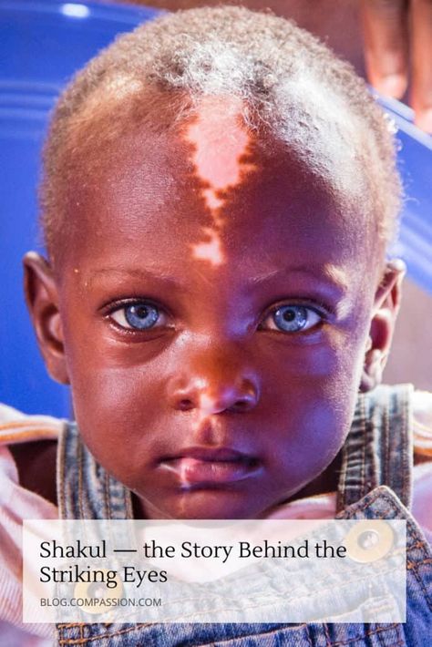 Shakul’s blue eyes are mesmerizing. But the story behind them will capture your hearts. Read this blog post to see how this little boy’s unique differences have affected his life – and how he inspires people in his Ugandan community each day. Waardenburg Syndrome, Heterochromia Eyes, People With Blue Eyes, Special Needs Teacher, Rare Genetic Disorders, Blue Eyed Baby, Compassion International, Sweet Hug, Different Colored Eyes