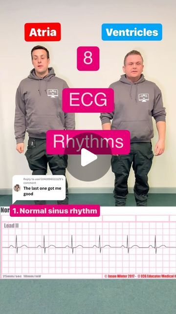 Ecg Rhythms Cheat Sheets, Ekg Rhythms, Paramedic Student, Cardiology Nursing, Ekg Interpretation, Ecg Interpretation, Cardiac Rhythms, Doctor Hospital, Heart Rhythms