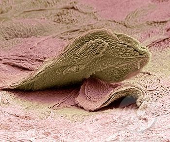 Scanning Electron Microscope Images, Electron Microscope Images, Scanning Electron Microscope, Scanning Electron Micrograph, Microscopic Photography, Micro Photography, Squamous Cell, Microscopic Images, Electron Microscope