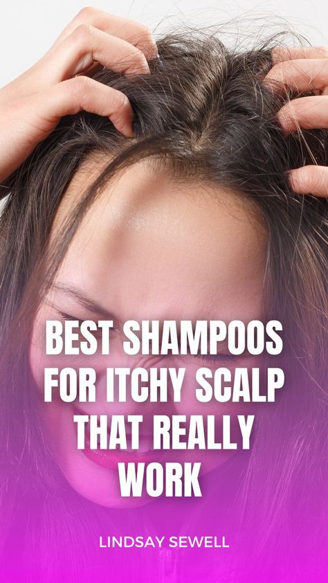 Best Shampoo And Conditioner For Dry Scalp, Scalp Irritation Remedies, Irritated Scalp Remedies, Best Shampoo For Dry Scalp, How To Stop Itchy Scalp, Dry Itchy Scalp Remedy, Remedy For Itchy Scalp, Oil For Itchy Scalp, Itchy Dry Scalp Remedy