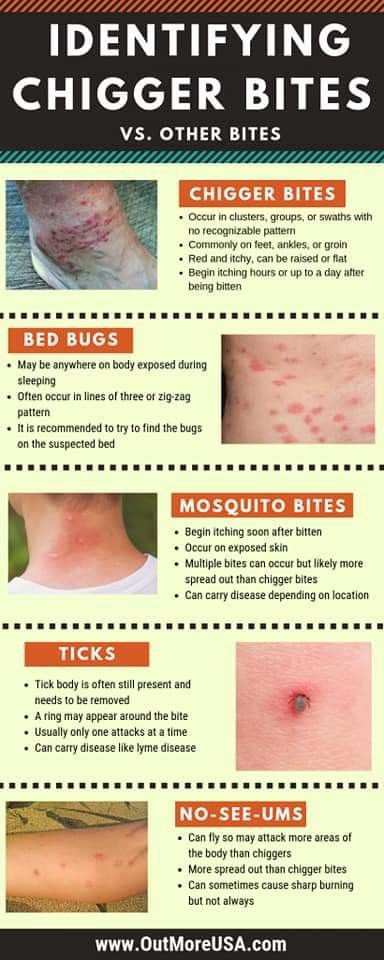 Chigger Bite Remedy, Types Of Bug Bites, Remedies For Mosquito Bites, Bug Bites Remedies, Get Rid Of Bed Bugs, Rid Of Bed Bugs, Bed Bug Bites, Fly Repellant, Bed Bug