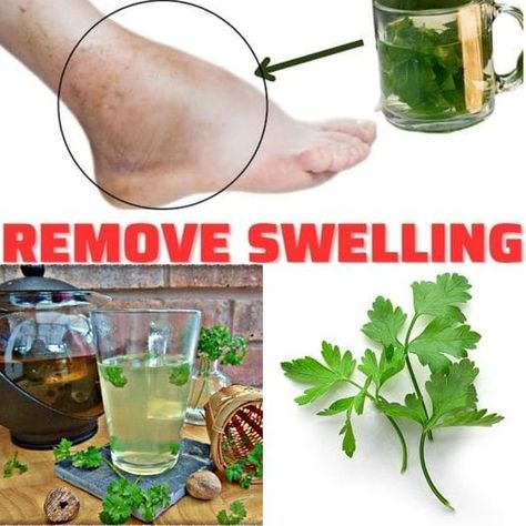 Dr Barbara O'Neill Healthy Recipes For Beginners (FANS GROUP) | If you drink this TEA, you will quickly remove the swelling of your legs, ankles and feet... | Facebook Feet Swelling, Parsley Tea, Calming Tea, Cleanse Your Liver, Natural Diuretic, Homemade Tea, Swollen Legs, Herbal Drinks, Refreshing Food