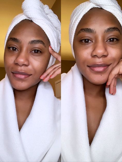 My Skin Is Kind of Perfect Right Now Thanks to This Exact 30-Day Routine Skin Care Routine Over 50, Congested Skin, Smoother Skin, How To Stay Awake, Puffy Eyes, Rosehip Oil, Free Makeup, My Skin, Smooth Skin