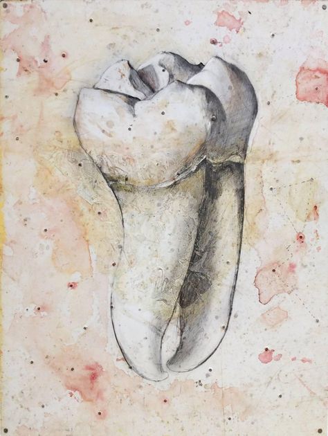 Tooth Painting, Tooth Drawing, Dentist Cartoon, Dentistry Clinic, Tooth Art, Diy Projects For Couples, Dentist Art, Mixed Media Drawing, Media Drawing