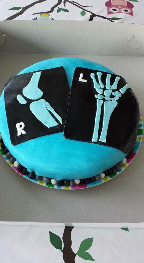 X-Ray cake Radiology Cakes Ideas, Radiologist Cake, Radiology Cookies, Radiology Cake, Medical Cake, Medical Party, Half Birthday Cakes, Doctor Cake, 70th Birthday Cake