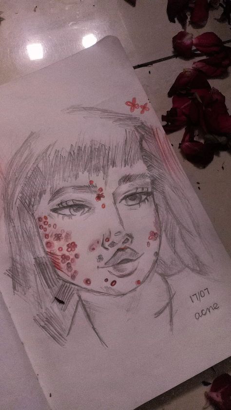 Drawing Insecurities Sketch, Acne Art Drawing, Insecure Draw, How To Draw Acne, Insecurity Sketch, Acne Insecurities, Drawing My Insecurities, Drawing Acne, Drawing Insecurities