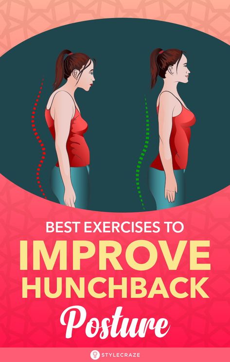 Best Exercises To Get Rid Of A Hunchback: Are you worried about your back posture? Have you often experienced trouble at work while trying to sit? Do you think having a hunchback is making you less attractive and confident? If that was a yes, then this article would be just the one for you.Some of the best hunchback posture exercises have been enlisted here. #Health #Fitness #Exercises #Posture Hunchback Posture, Female Posture, Back Posture, Fix Your Posture, Back Fat Workout, Posture Exercises, Fitness Exercises, Relieve Back Pain, Health And Fitness Articles