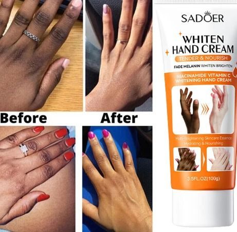 Dark Knuckles Fast Whitening Serum Anti Cracking Cream Pigmentation Correctors For Black Skin Intense Stains Remover Products aliexpress.com Best Body Cream, Dark Knuckles, Fathers Day Poems, Liquid Hair, Whitening Cream, Stain Remover, Hand Cream, Body Cream, Serum