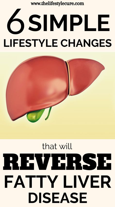 Home Medicine, Liver Diet, Simpler Lifestyle, Diet Exercise, Liver Detox, Healthy Liver, Liver Health, Chronic Disease, Lifestyle Changes