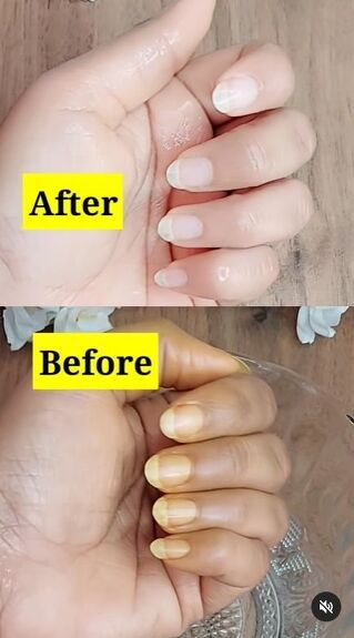 This guide shares a hack for turning yellow nails white. Learn how to whiten nails in this step-by-step tutorial. Diy Nail Whitener, How To Get Whiter Nails At Home, How To Clean Yellow Nails, Get Rid Of Yellow Nails, How To Get Nails White, How To Whiten Fingernails, How To Whiten Nails Naturally, How To Whiten Yellow Nails, How To Remove Yellow Stains From Nails