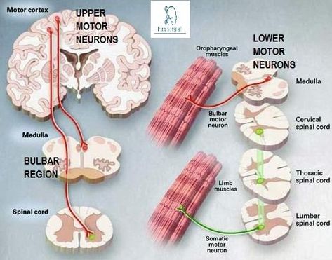 Neuron Diagram, Motor Neurone Disease, Nervous System Anatomy, Scanning Electron Micrograph, Muscle Twitching, Motor Neuron, Muscle Atrophy, Degenerative Disease, Cranial Nerves