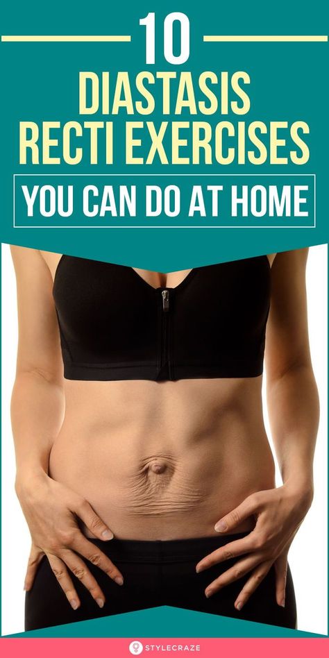 10 Diastasis Recti Exercises You Can Do At Home: To treat diastasis recti, you must exercise targeting the deep abdominal muscles and the pelvic floor muscles. Do these 10 best diastasis recti exercises at home daily to see a visible change and feel better. Read on to know about the symptoms, causes, and exercises to treat diastasis recti. #WomensHealth #Health #Fitness #HealthCare Get Rid Of Bloated Stomach, Exercises For Diastasis Recti, Monthly Goal Setting, Diastasis Recti Exercises, Progress Tracker, Ayurvedic Skin Care, Monthly Goal, Exercises At Home, Bloated Stomach