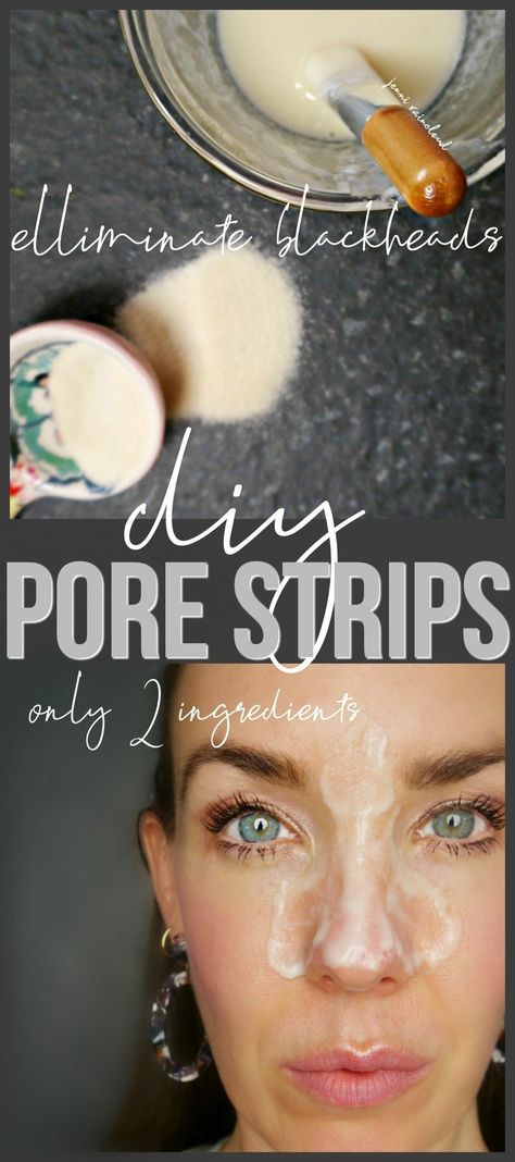 Diy Pore Strips, Homemade Pore Strips, Flat Tummy Tips, Pore Cleansing Mask, Pimples Under The Skin, Pimples Overnight, Pore Strips, Pore Cleanser, How To Get Rid Of Pimples