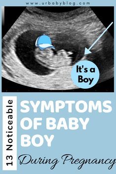 Gender Reveal Boy Announcement, It’s A Boy Pregnancy Announcement, Baby Boy Ultrasound Pictures, Boy Or Girl Prediction Signs, We Are Pregnant Announcement, Baby Boy Gender Announcement, Gender Announcement Pictures, Monthly Pregnancy Pictures, Boy Vs Girl Pregnancy