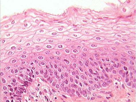 stratified squamous epithelium Epithelium Tissue, Simple Squamous Epithelium, Squamous Epithelium, Epithelial Tissue, Stratified Squamous Epithelium, Squamous Cell, Biology Facts, Connective Tissue, Anatomy And Physiology