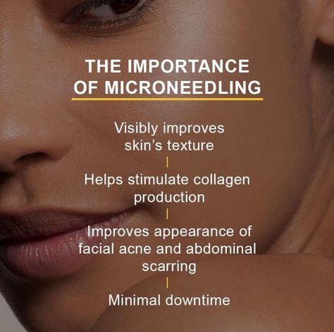 Microneedling Before And After, Microneedling Benefits, Skinpen Microneedling, Dermapen Microneedling, Microneedling Pen, Laser Facial, Aesthetic Nurse, Laser Hair Reduction, Micro Needling