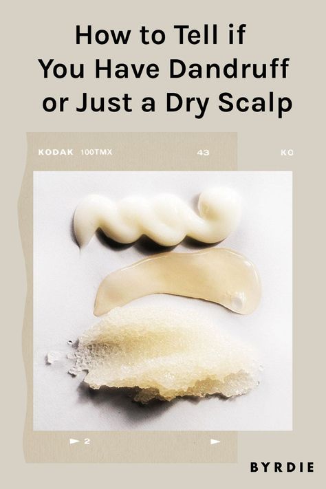 Treating Dandruff Naturally, Scalp Scrub For Dry Scalp, Diy For Dandruff Dry Scalp, Diy For Itchy Scalp, Curly Hair Dandruff, Best Shampoo For Flaky Scalp, Natural Remedy For Dandruff, Best Shampoo And Conditioner For Dandruff Dry Scalp, What To Use For Dandruff