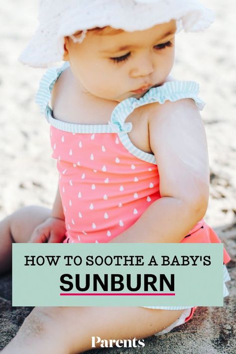 Sun Burn Remedy, Baby Sunburn, Sunburn On Face, Baby Vicks, Sunburn Face, Sunburn Blisters, Sunburnt Face, Home Remedies For Sunburn, Get Rid Of Sunburn