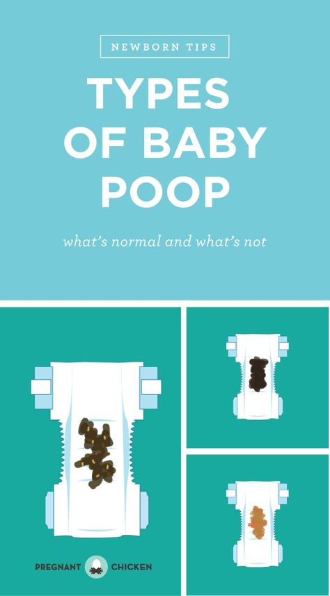 Baby Poop Chart, Baby Poop Guide, Prepping For Pregnancy, Newborn Formula, Baby Poop, Yellow Milk, Formula Fed Babies, 2 Month Old Baby, What Is Normal