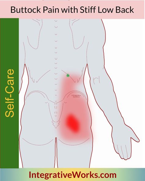 Self-Care - Buttock Pain with Stiff Low-Back - Integrative Works Mid Back Pain, Piriformis Stretch, Pinched Nerve, Upper Back Pain, Trigger Points, Hip Pain, Low Back Pain, Back Exercises, Back Pain Relief